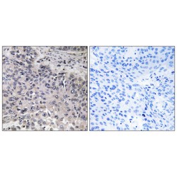 Complement Component 1q Subcomponent C (C1qC) Antibody