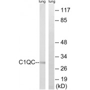 Western blot analysis of extracts from rat lung cells, using C1QC antibody.