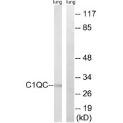 Western blot analysis of extracts from rat lung cells, using C1QC antibody.