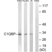 Western blot analysis of extracts from Jurkat cells, K562 cells and HUVEC cells, using C1QBP antibody.