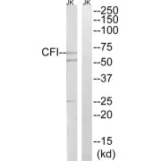 Western blot analysis of extracts from Jurkat cells, using CFI antibody.