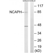 Western blot analysis of extracts from COLO cells, using NCAPH antibody.