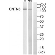 Western blot analysis of extracts from Jurkat cells and A549 cells, using CNTN6 antibody.