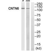 Western blot analysis of extracts from Jurkat cells and A549 cells, using CNTN6 antibody.