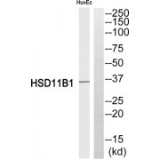 Western blot analysis of extracts from HuvEc cells, using HSD11B1 antibody.