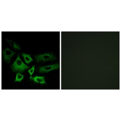 5'-Nucleotidase, Cytosolic IA (NT5C1A) Antibody