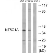 Western blot analysis of extracts from MCF-7 cells and HepG2 cells, using 5'-Nucleotidase, Cytosolic IA (NT5C1A) Antibody.