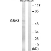 Western blot analysis of extracts from HuvEc cells, using GBA3 antibody. The lane on the right is blocked with the synthesized peptide.