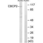 Western blot analysis of extracts from HuvEc cells, using CBCP2 antibody.