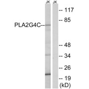 Western blot analysis of extracts from Jurkat cells, using PLA2G4C antibody.