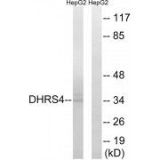 Western blot analysis of extracts from HepG2 cells, using DHRS4 antibody.