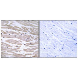 DnaJ Homolog Subfamily B Member 11 (DNAJB11) Antibody