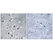 Immunohistochemistry analysis of paraffin-embedded human brain tissue using MARCHF4 antibody.