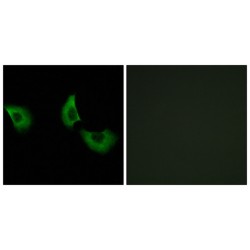 EGF Containing Fibulin Extracellular Matrix Protein 2 (EFEMP2) Antibody