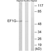 Western blot analysis of extracts from HepG2 cells and HUVEC cells, using EEF1G antibody.