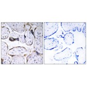 Immunohistochemistry analysis of paraffin-embedded human placenta tissue using ELOVL3 antibody.