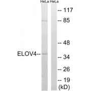 Western blot analysis of extracts from HeLa cells, using ELOVL4 antibody.