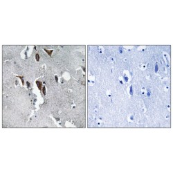 ELOVL Fatty Acid Elongase 5 (ELOVL5) Antibody