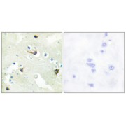 Immunohistochemistry analysis of paraffin-embedded human brain tissue using EPHB1/2/3 antibody.