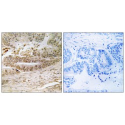 Epsin 3 (EPN3) Antibody