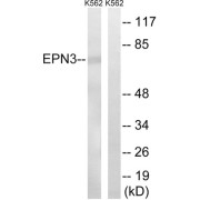 Western blot analysis of extracts from K562 cells, using EPN3 antibody.