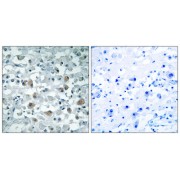 Immunohistochemistry analysis of paraffin-embedded human brain tissue using EIF1AY antibody.
