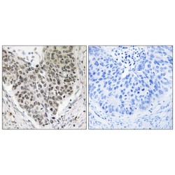 Amyotrophic Lateral Sclerosis 2 Chromosomal Region Candidate Gene 8 Protein (ALS2CR8) Antibody