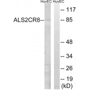 Western blot analysis of extracts from HuvEc cells, using ALS2CR8 antibody.
