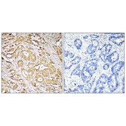 3-Galactosyl-N-Acetylglucosaminide 4-Alpha-L-Fucosyltransferase FUT3 (FUT3) Antibody