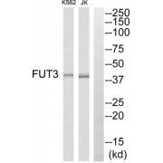 Western blot analysis of extracts from K562 cells and Jurkat cells, using MRPS7 antibody. The lane on the right is blocked with the synthesized peptide.