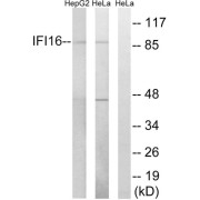 Western blot analysis of extracts from HeLa cells and HepG2 cells, using IFI16 antibody.