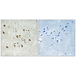 Tubulin Gamma Complex Associated Protein 6 (TUBGCP6) Antibody