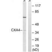Western blot analysis of extracts from Jurkat cells, using GJA4 antibody.