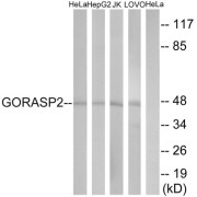 Western blot analysis of extracts from HeLa cells, HepG2 cells, Jurkat cells and LOVO cells, using GORASP2 antibody.