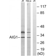 Western blot analysis of extracts from Jurkat cells and HeLa cells, using AIG1 antibody.