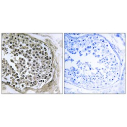 Growth Inhibition And Differentiation-Related Protein 88 (GIDRP88) Antibody