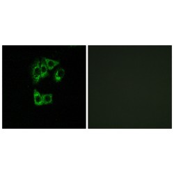 GTPase IMAP Family Member 2 (GIMAP2) Antibody