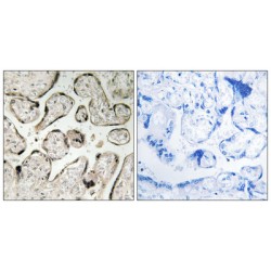 GTPase IMAP Family Member 5 (GIMAP5) Antibody