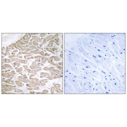 GTP-Binding Protein RAD (RAD) Antibody