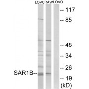 Western blot analysis of extracts from LOVO cells and RAW264.7 cells, using SAR1B antibody.