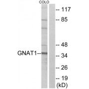 Western blot analysis of extracts from COLO cells, using GNAT1 antibody.
