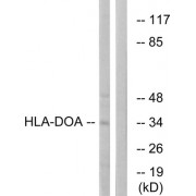 Western blot analysis of extracts from COLO cells, using HLA-DOA antibody.