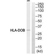 Western blot analysis of extracts from 293 cell, using HLA-DOB antibody.