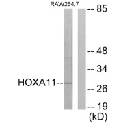 Western blot analysis of extracts from RAW264.7 cells, using HOXA11/D11 antibody.