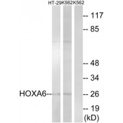 Western blot analysis of extracts from HT-29 cells and K562 cells, using HOXA6 antibody.