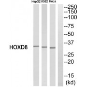 Western blot analysis of extracts from HepG2 cells, K562 cells and HeLa cells, using HOXD8 antibody.