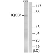 Western blot analysis of extracts from K562 cells, using IQCB1 antibody.