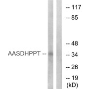 Western blot analysis of extracts from COLO cells, using AASDHPPT antibody.