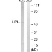 Western blot analysis of extracts from COLO cells, using LIPI antibody.