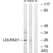 Western blot analysis of extracts from Jurkat cells and HepG2 cells, using LDLRAD1 antibody.